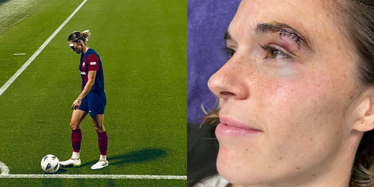 La jugadora española recibió un codazo por parte de una rival que le causó una herida.